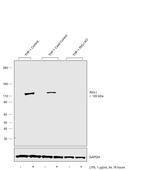 RIG-I Antibody in Western Blot (WB)