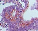 GBP1 Antibody in Immunohistochemistry (Paraffin) (IHC (P))