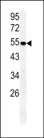 SLC43A2 Antibody in Western Blot (WB)