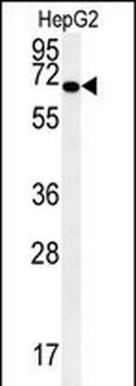 KEAP1 Antibody in Western Blot (WB)