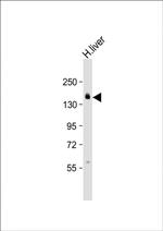 AEBP1 Antibody in Western Blot (WB)