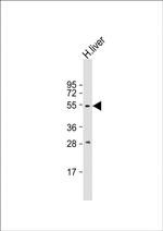 Angiopoietin 2 Antibody in Western Blot (WB)