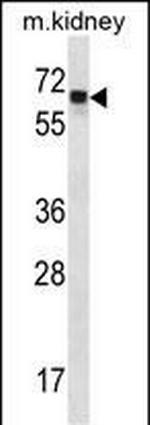 Angiopoietin 2 Antibody in Western Blot (WB)