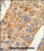 AMACR Antibody in Immunohistochemistry (Paraffin) (IHC (P))