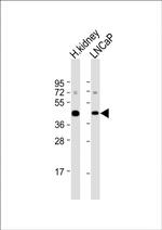 AMACR Antibody in Western Blot (WB)