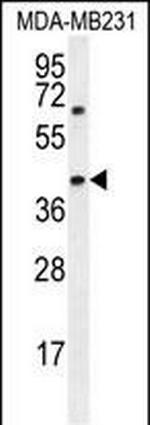 AMACR Antibody in Western Blot (WB)