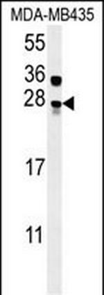 MUTED Antibody in Western Blot (WB)