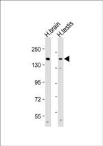 MRP3 Antibody in Western Blot (WB)