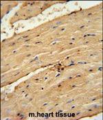 TIMP4 Antibody in Immunohistochemistry (Paraffin) (IHC (P))