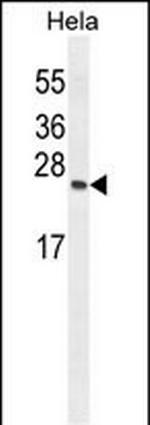 TIMP4 Antibody in Western Blot (WB)