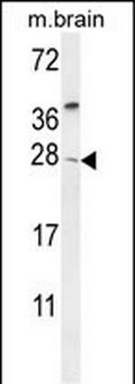 TIMP4 Antibody in Western Blot (WB)