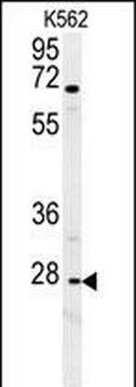 CXCR3 Antibody in Western Blot (WB)