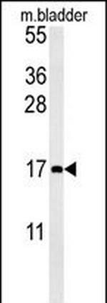 CCL4 Antibody in Western Blot (WB)