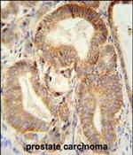 Claudin 7 Antibody in Immunohistochemistry (Paraffin) (IHC (P))