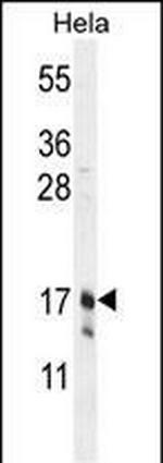 Claudin 7 Antibody in Western Blot (WB)