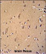 GCC2 Antibody in Immunohistochemistry (Paraffin) (IHC (P))