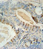 GCNT2 Antibody in Immunohistochemistry (Paraffin) (IHC (P))