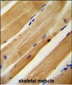 MLXIP Antibody in Immunohistochemistry (Paraffin) (IHC (P))