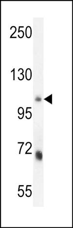 MLXIP Antibody in Western Blot (WB)