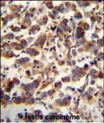 TFAM Antibody in Immunohistochemistry (Paraffin) (IHC (P))