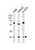 TFAM Antibody in Western Blot (WB)