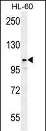 LNPEP Antibody in Western Blot (WB)