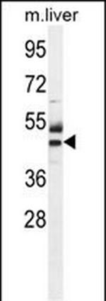 CTU1 Antibody in Western Blot (WB)