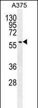 SPDYE3 Antibody in Western Blot (WB)