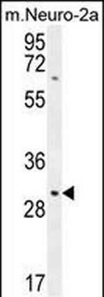 TMEM65 Antibody in Western Blot (WB)