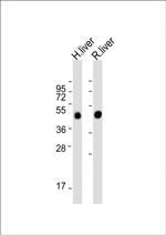 METTL4 Antibody in Western Blot (WB)