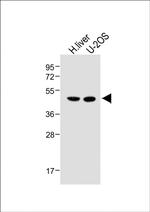 METTL4 Antibody in Western Blot (WB)