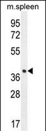 LHFPL5 Antibody in Western Blot (WB)