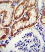 GATM Antibody in Immunohistochemistry (Paraffin) (IHC (P))