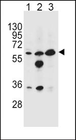 GATM Antibody in Western Blot (WB)