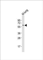 Angiopoietin 1 Antibody in Western Blot (WB)