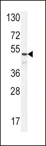 Angiopoietin 1 Antibody in Western Blot (WB)