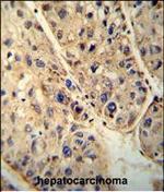 ABCD1 Antibody in Immunohistochemistry (Paraffin) (IHC (P))