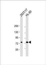 ABCD1 Antibody in Western Blot (WB)