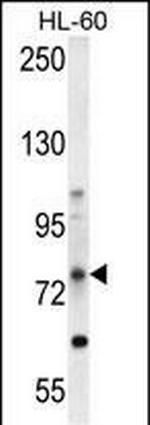 ABCD1 Antibody in Western Blot (WB)