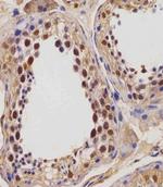 IGF2BP1 Antibody in Immunohistochemistry (Paraffin) (IHC (P))