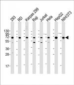 IGF2BP1 Antibody in Western Blot (WB)