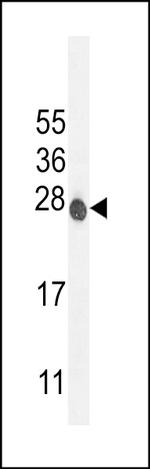 ATP6V0C Antibody in Western Blot (WB)