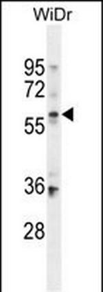 BCMO1 Antibody in Western Blot (WB)