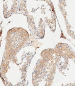 Cathepsin A Antibody in Immunohistochemistry (Paraffin) (IHC (P))