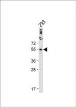 Cathepsin A Antibody in Western Blot (WB)