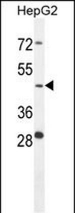 Cathepsin A Antibody in Western Blot (WB)