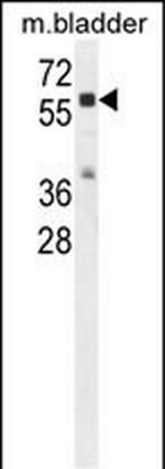 Cathepsin A Antibody in Western Blot (WB)