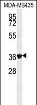 EXO5 Antibody in Western Blot (WB)