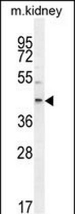 E2F2 Antibody in Western Blot (WB)