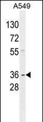 GNAT3 Antibody in Western Blot (WB)